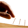 Acupuncture